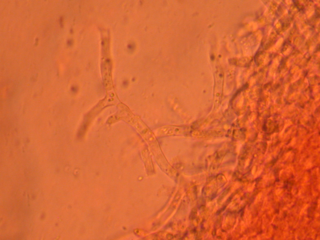 Hypocreopsis lichenoides